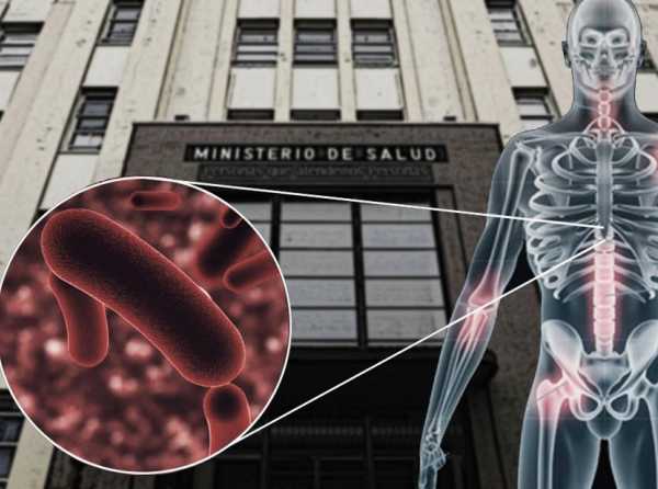 Minsa, Congreso, tuberculosis e innovaci&oacute;n