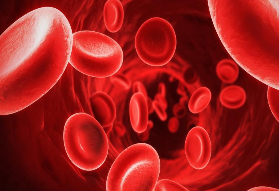 La anemia de los ricos