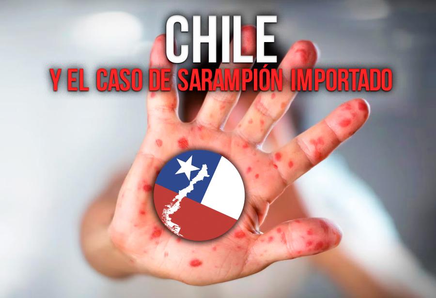 Chile y el caso de sarampión importado