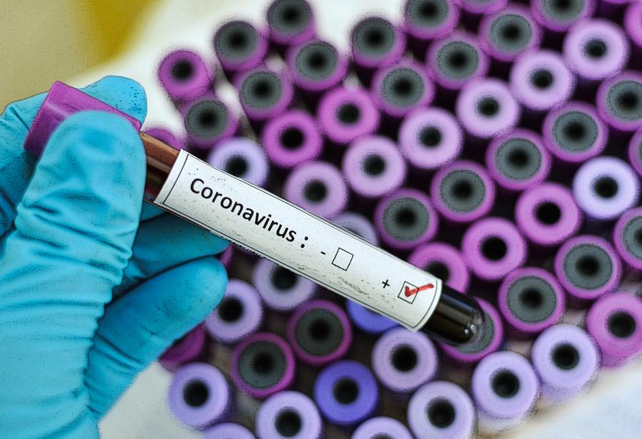 Otro coronavirus llega desde Asia