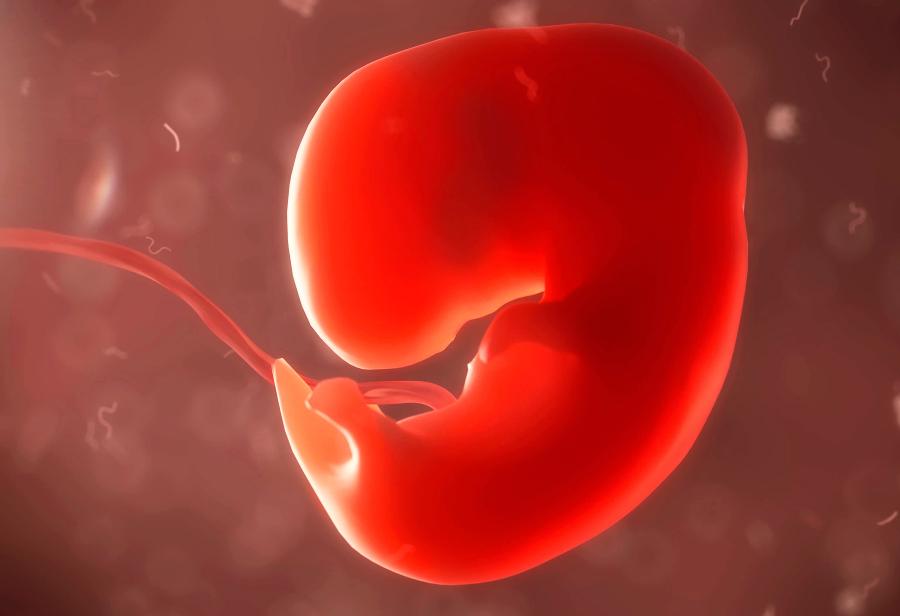 Matar no es un derecho