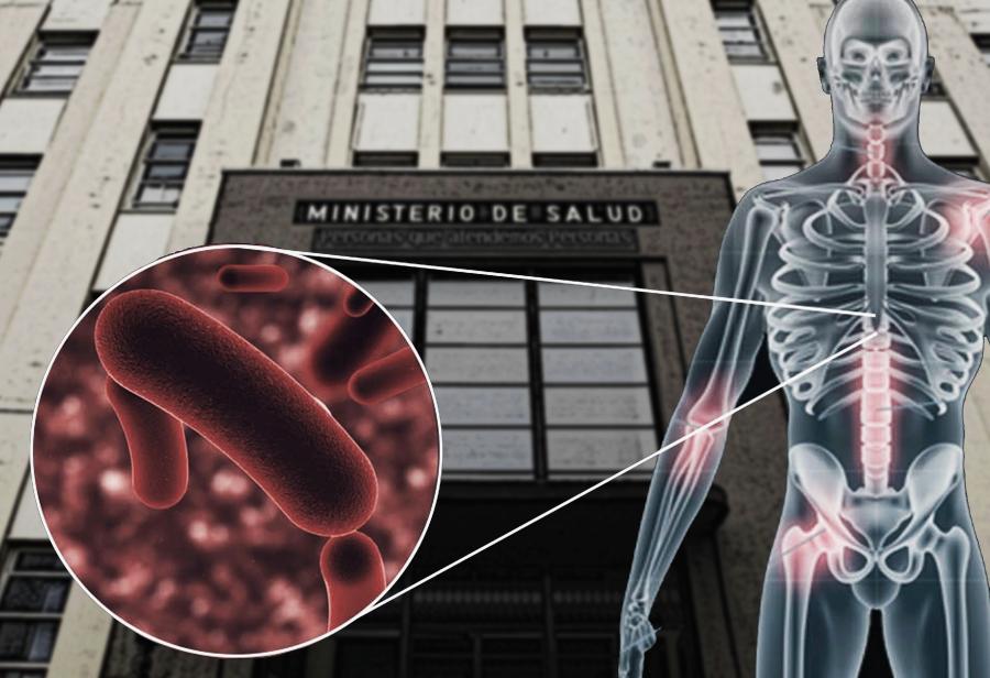 Minsa, Congreso, tuberculosis e innovaci&oacute;n